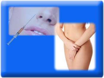Remodelling Labia Majora with Fat, Lipofilling Fat Transfer Labia Majora, Female Genital Lipofilling