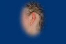 A bal fül csaknem merőlegesen áll a fejhez képest.