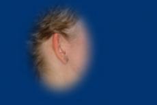 A jobb fül hasonlóan viszonyul a fejhez.
